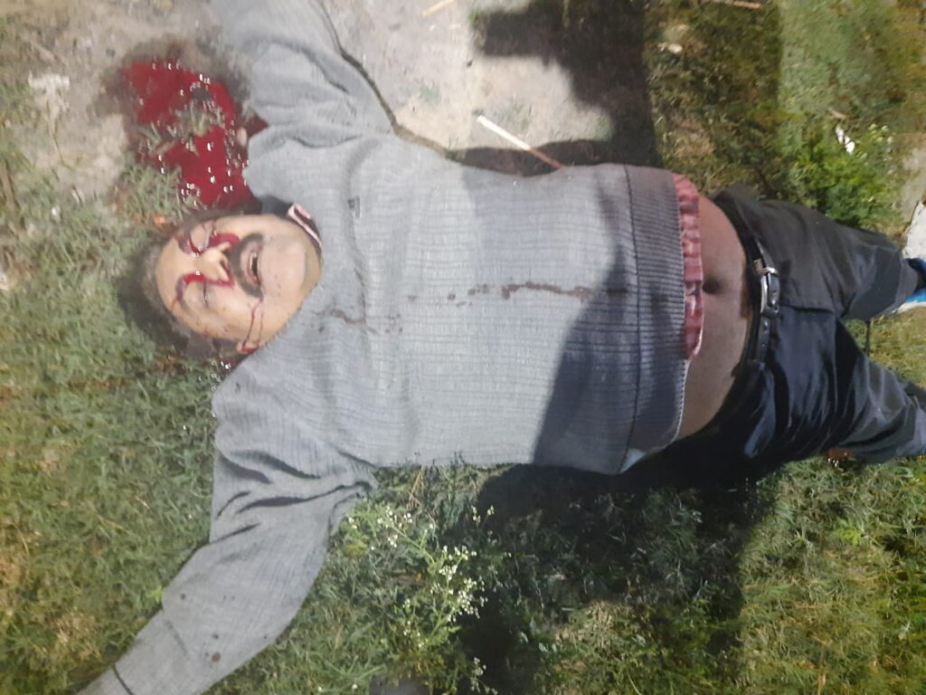 पत्नी के सामने गोली मार कर डॉक्टर ने कर ली आत्महत्या,,