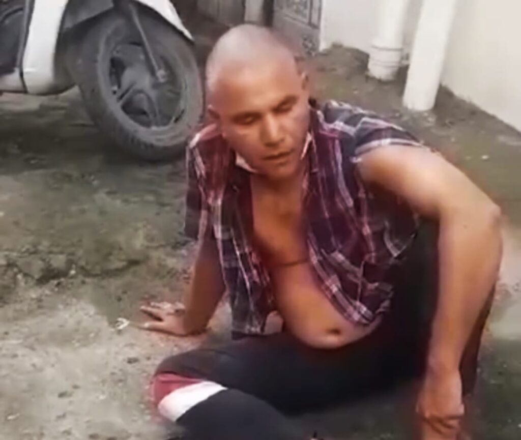 ऋषिकेश में यूट्यूबर पत्रकार पर शराब माफिया के हमले की घटना पर पुलिस कप्तान अजय सिंह ने लिया बड़ा एक्शन,,,