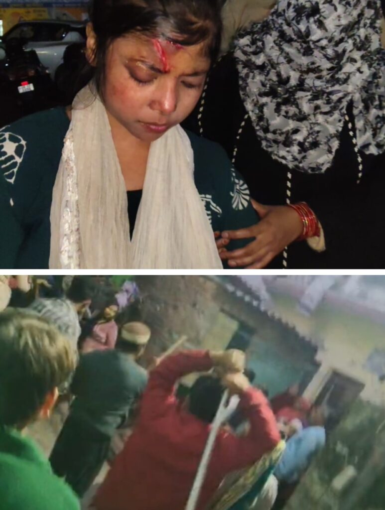 रुड़की के महिग्रान में कहासुनी के बाद दो पक्षों के बीच जमकर हुई मारपीट,घटना में एक पक्ष के दो महिलाओं समेत कुल छह लोग घायल,पुलिस जुटी जांच में,,,